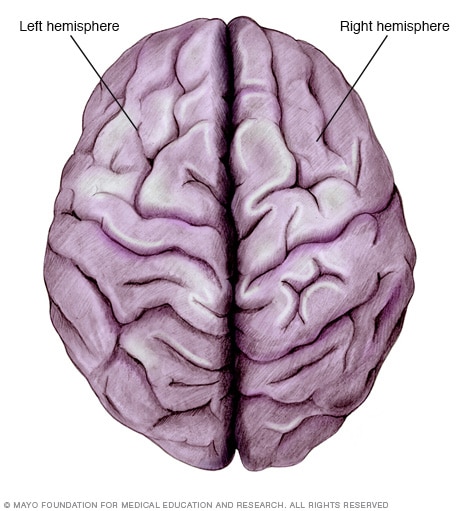 Brain hemispheres