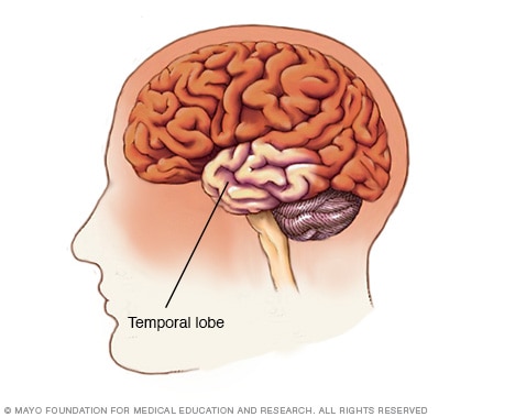 Location of temporal lobe